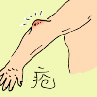 疮 ulcer