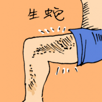 生蛇 shingles