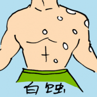 白蚀 vitiligo skin disease