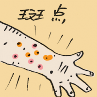 斑点 mottle