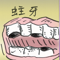 蛀牙 decayed tooth