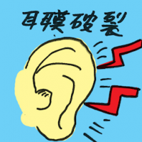 耳膜破裂 ruptured eardrum