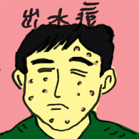 出水痘 chicken pox