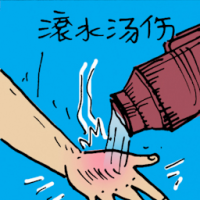 滚水烫伤 scalded by boiling water