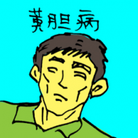 黄胆病 jaundice