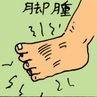 脚肿 swollen leg