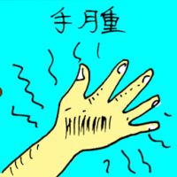 手肿 swollen hand
