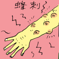 蜂刺 stung by bee
