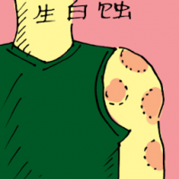 生白蚀 skin disease