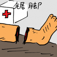 锯脚 leg sawed off / amputated