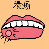 溃疡 lip ulcer
