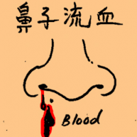 鼻子流血 nose bleeding