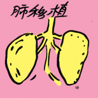 肺移植 lung transplant