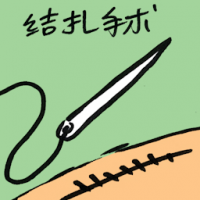 结扎手术 ligation
